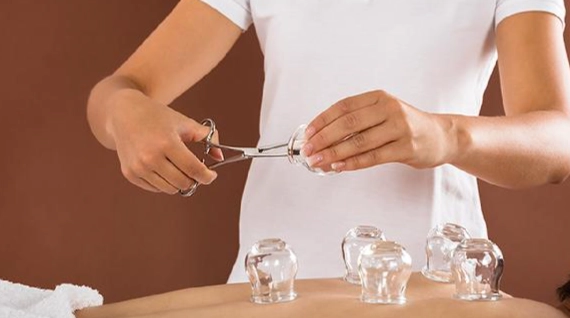 拔罐顏色很深 拔罐顏色很深