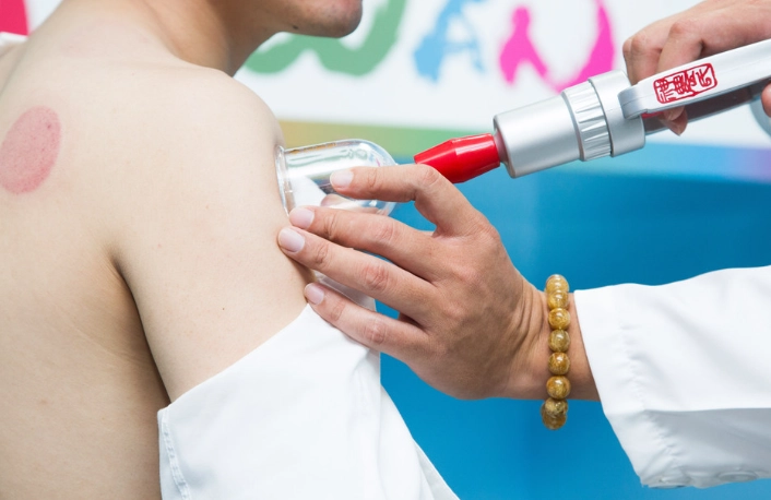 拔罐顏色解析 拔罐顏色解析