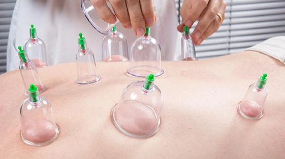 拔罐顏色意義 拔罐顏色意義