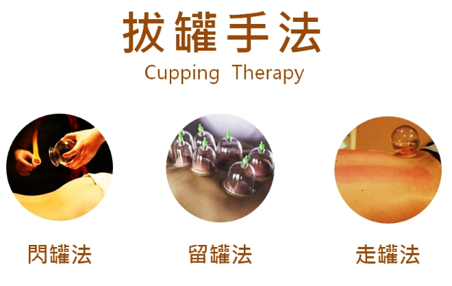 拔罐瘀青消退時間