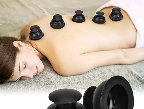 拔罐後瘀青處理 拔罐後瘀青處理