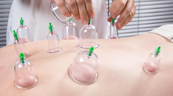 肩膀拔罐反應