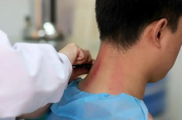 刮痧護理方法 刮痧護理方法