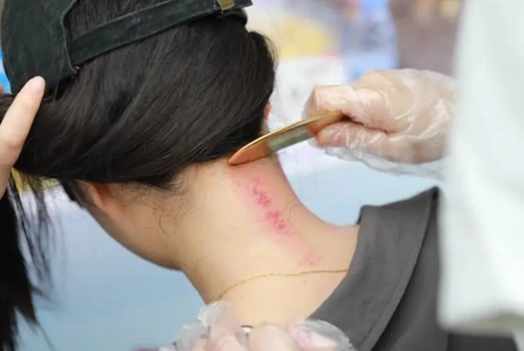 刮痧後洗澡注意事項 刮痧後洗澡注意事項