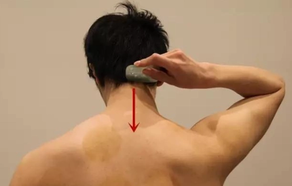 脊椎刮痧方法 脊椎刮痧方法