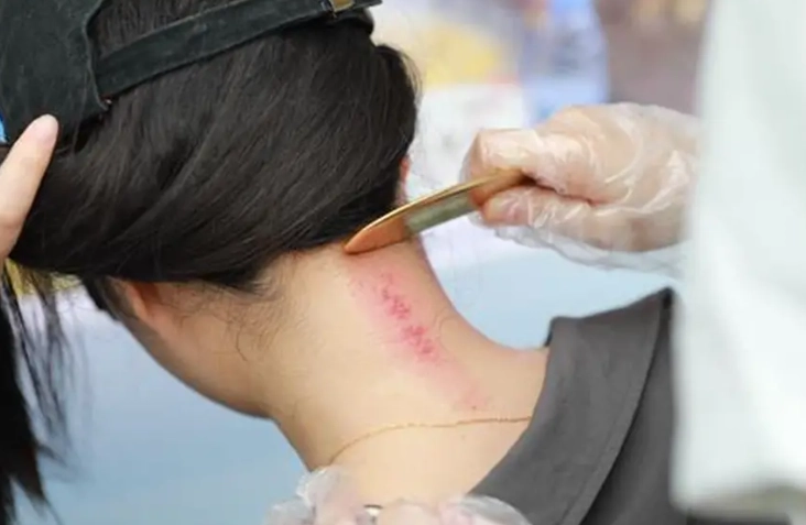 刮痧洗澡時間 刮痧洗澡時間