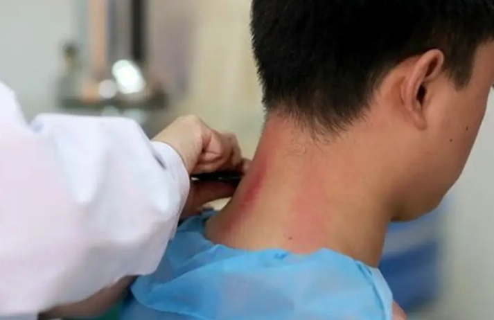 刮痧後洗澡禁忌 刮痧後洗澡禁忌