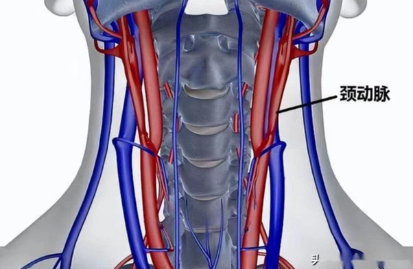 頸動脈剝離 症狀