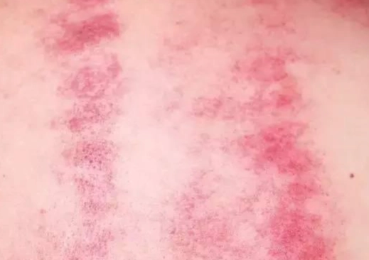 心經刮痧手法 心經刮痧手法