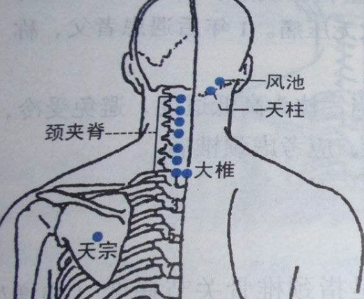 落枕穴道 落枕穴道