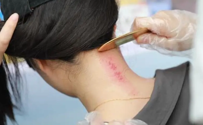 刮痧板推薦 刮痧板推薦