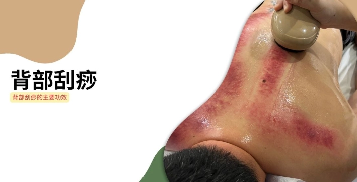 刮痧顏色代表什麼
